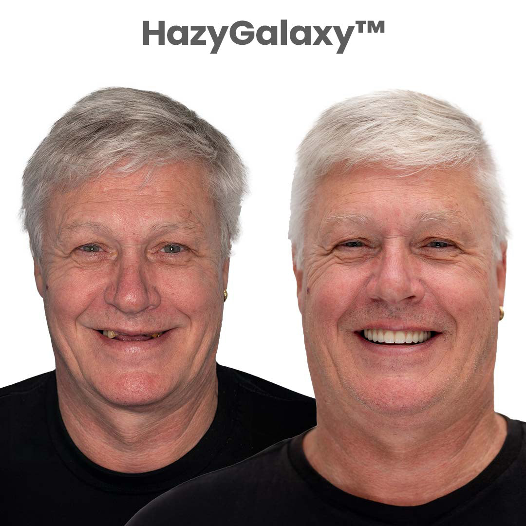 ⏰⏰ HazyGalaxy™ Custom-Fit Dentures  ENDS TODAY   70% OFF | Smile with Confidence